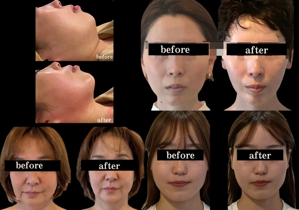 老け顔の原因とは…