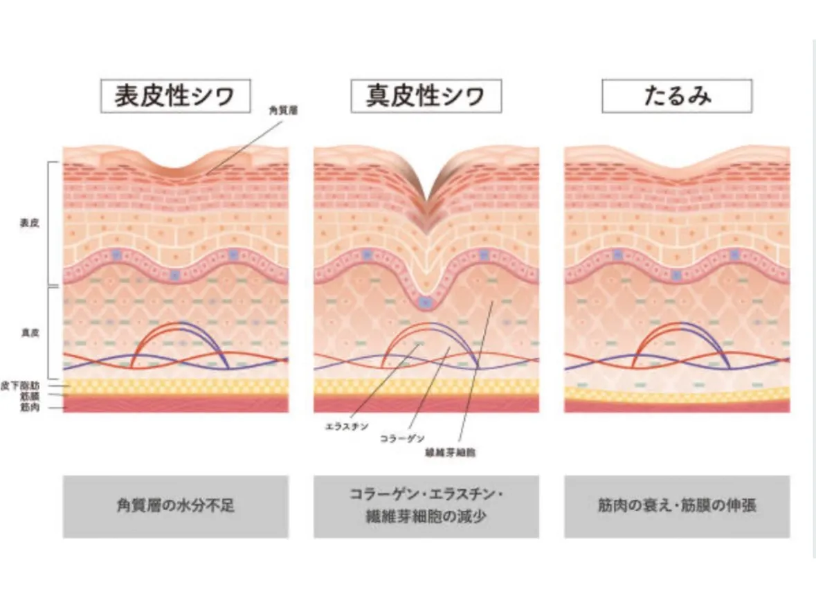 脂肪を増やして若返る⁉︎注射しない最新施術!!
